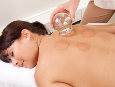 A woman getting a massage with a cupping technique while enjoying a glass of water.